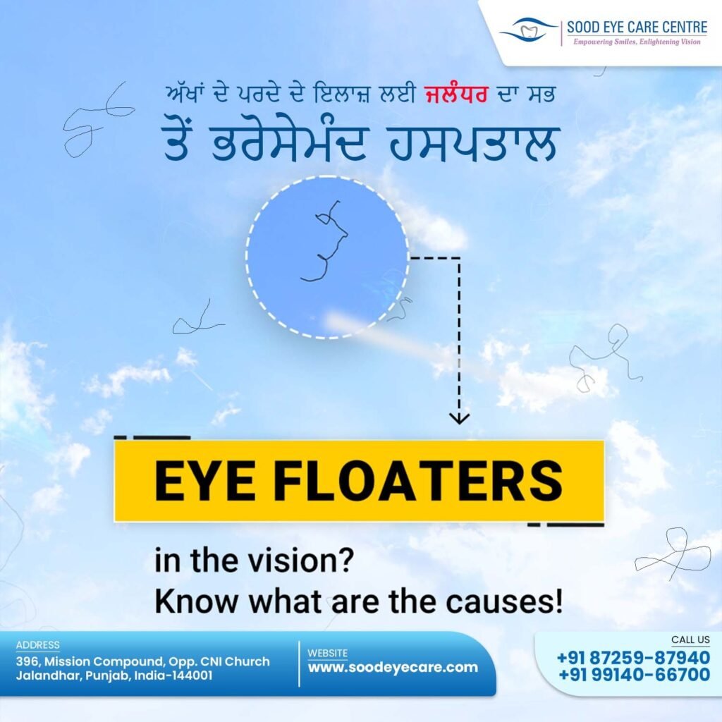 Flashes and floaters are visual disturbances often experienced as small spots, threads, or flashes of light in the field of vision. They are usually harmless and common with age, but sudden changes or an increase in their frequency may indicate retinal issues. Consultation with an eye specialist is advised for evaluation.