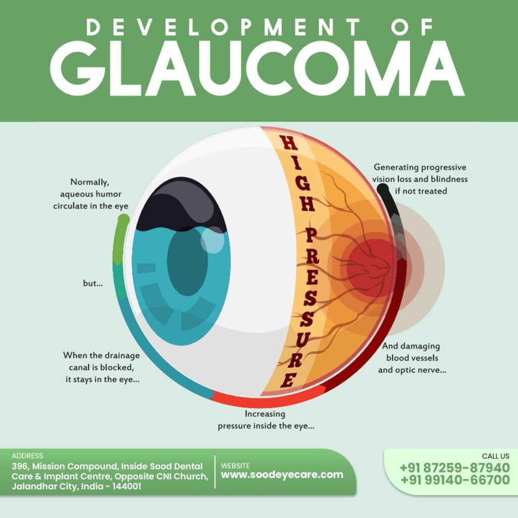 Glaucoma often develops without symptoms, leading to irreversible vision loss. Early signs include blurry vision, eye pressure, headaches, and peripheral vision loss. Regular eye checkups are crucial for timely detection and treatment.