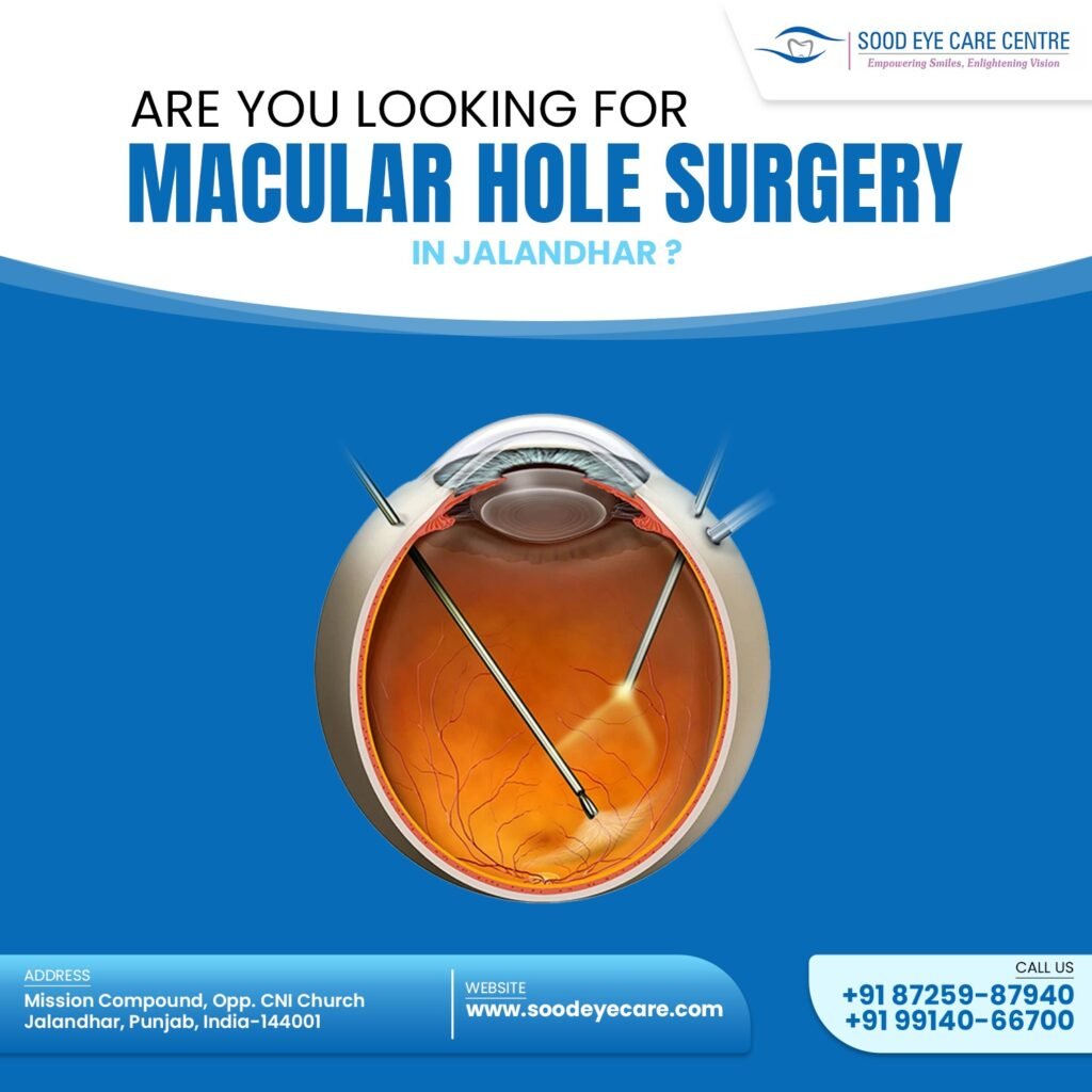 A macular hole can cause blurry or distorted central vision. Sood Eye Care offers advanced treatments, including vitrectomy surgery, to restore vision effectively. Early diagnosis is crucial for the best outcomes. Visit Sood Eye Care for expert macular hole treatment.