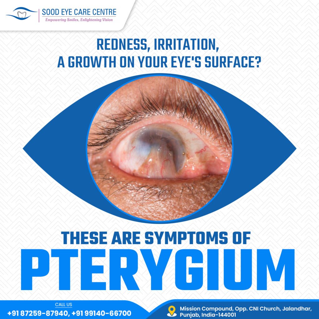 Pterygium is a benign eye growth caused by sun exposure. Symptoms include redness, irritation, dryness, and a visible tissue on the white of the eye. Advanced cases may affect vision.