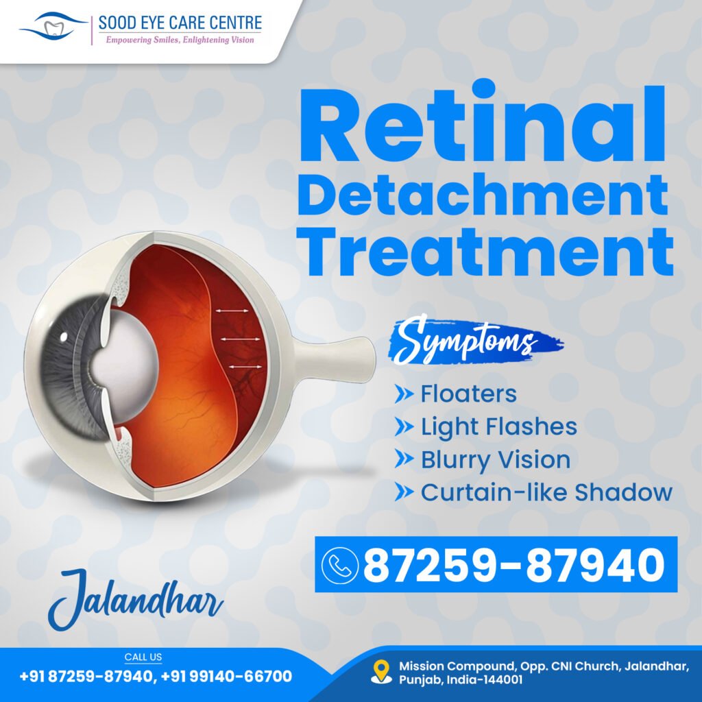 Retinal detachment is diagnosed through eye exams like OCT and ultrasound. Treatments include laser therapy, scleral buckling, and vitrectomy. Sood Eye Care Center, Jalandhar, offers expert care for effective treatment.