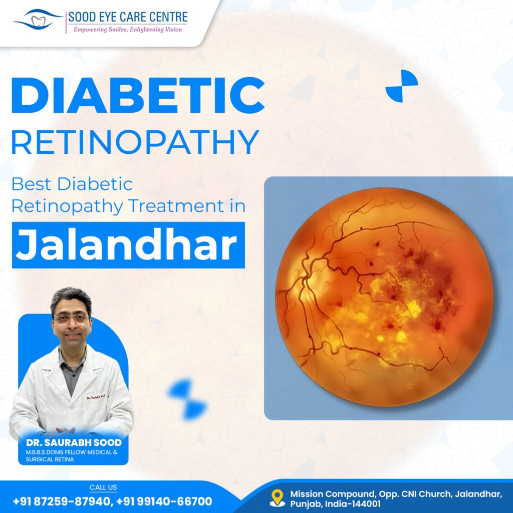Sood Eye Care offers expert treatment for diabetic retinopathy, ensuring early detection and advanced care. With cutting-edge technology and experienced specialists, they help protect your vision and prevent complications. Book a consultation today for the best eye care.